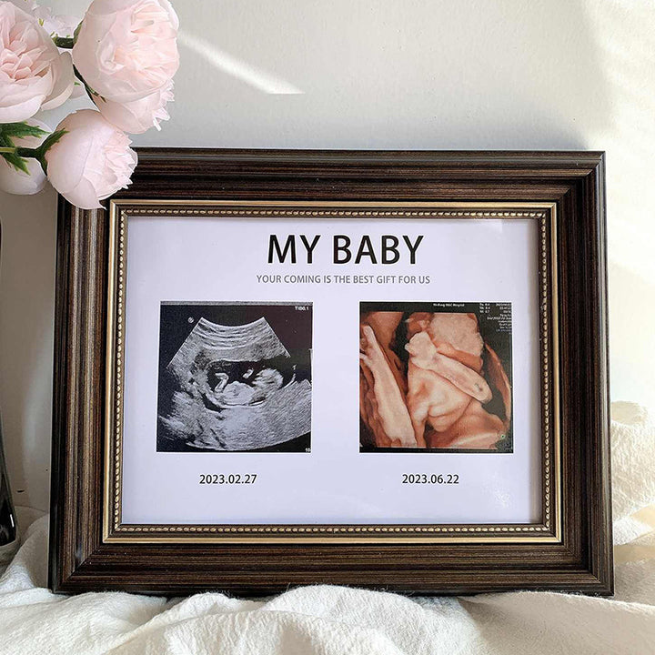 Personalized Ultrasound Photo Frame for Home Display